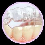 مزيت مهم D-cligner نسبت به Invisalign در داخل ايران 1 A6D6CADE CD5C 40E8 A2E4 976C54B8AA1B