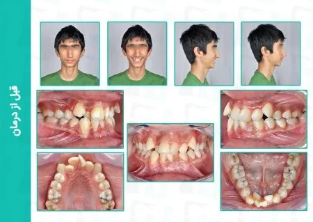 portfolio25 a