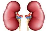 رابطه ارتودنسی و اختلالات کلیوی 1 download 2