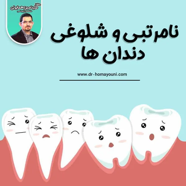 نامرتبی و شلوغی دندان ها 1 نامربتی و شلوغی دندان ها