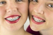ابتلای 40% از ایرانیان به ناهنجاریهای فک