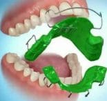دستگاه فانکشنال ارتودنسی 1 photo 84