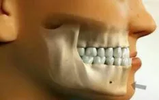 آندربایت چیست 1 photo 94