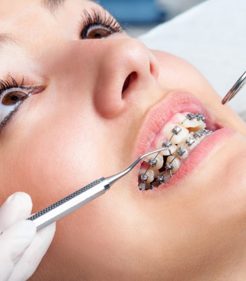orthodontist-s1 ارتودنسی چیست؟