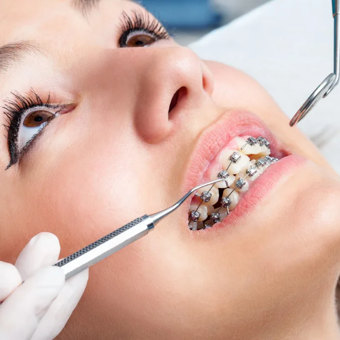 اورژانس های ارتودنسی کدامند؟ 1 orthodontist s1