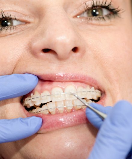 orthodontist-s11 ارتودنسی چیست؟
