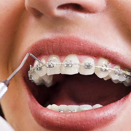 orthodontist-s2 ارتودنسی چیست؟