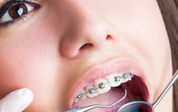 orthodontist-s3 ارتودنسی چیست؟