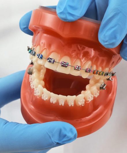 orthodontist-s5 ارتودنسی چیست؟