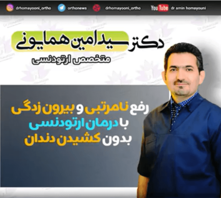 رفع نامرتبی و بیرون زدگی با درمان ارتودنسی بدون کشیدن دندان