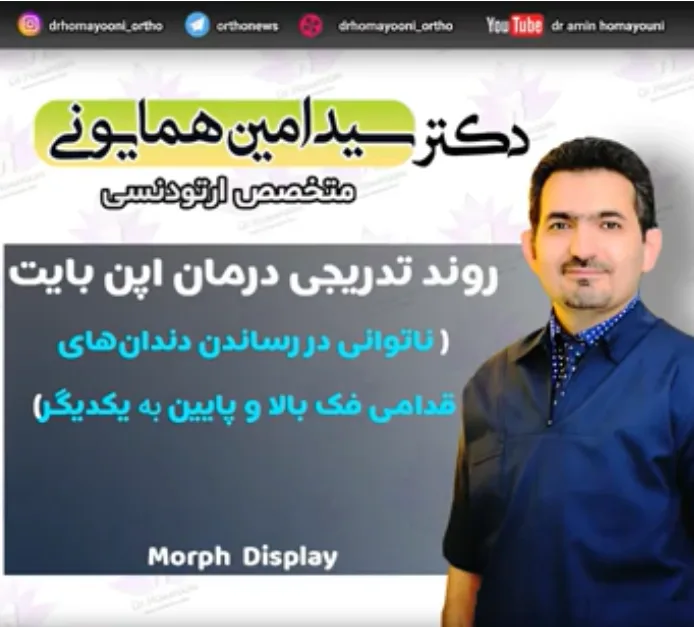 اپن بایت