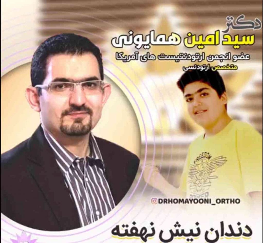 دندان نیش نهفته