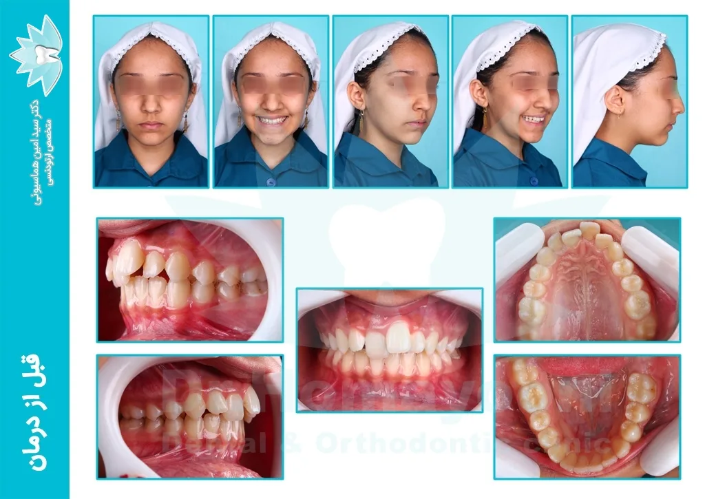 portfolio60 a