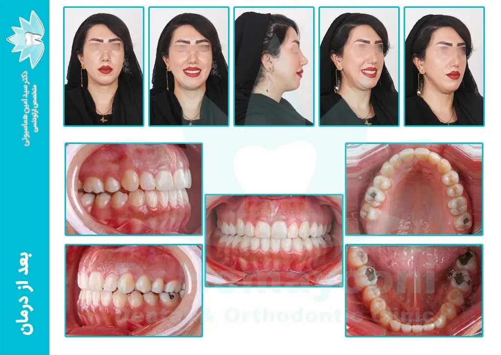 portfolio67 a