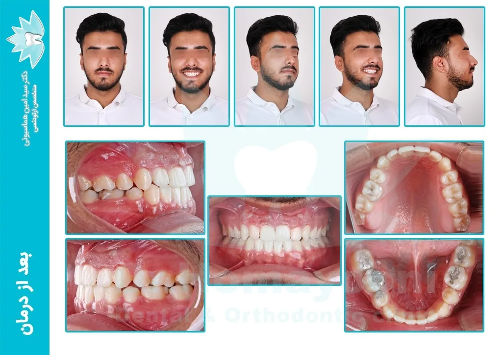 portfolio68 a