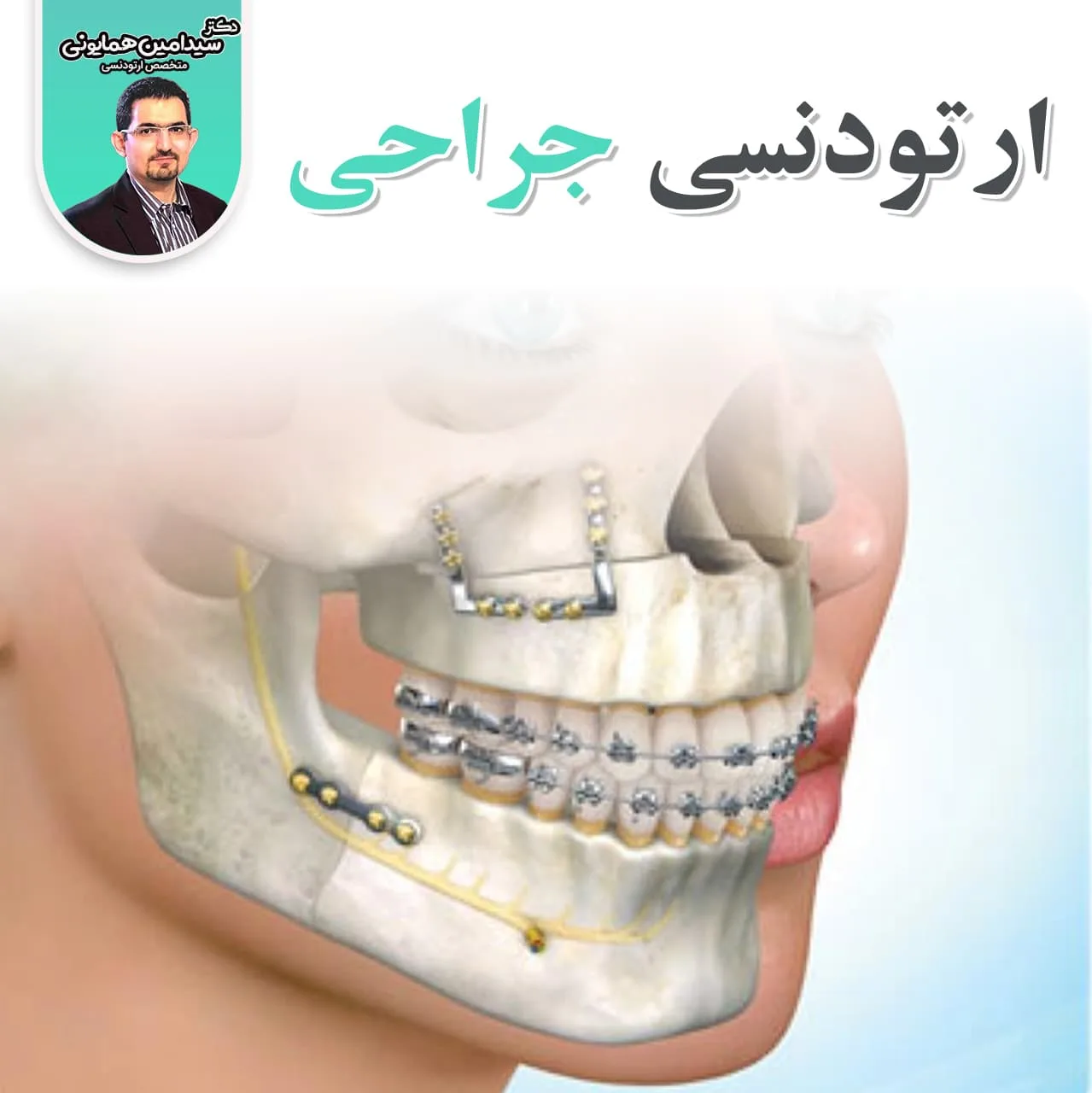 ارتودنسی جراحی 1 ارتودنسی جراحی