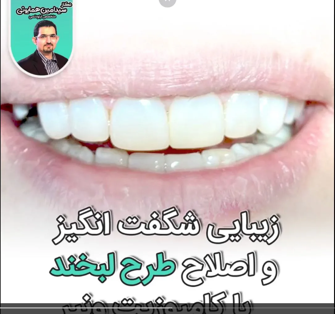 زیبایی شگفت انگیز