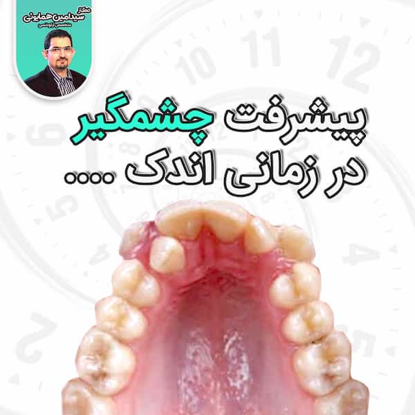 پیشرفت چشمگیر در زمان کم