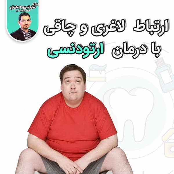 ارتباط چافی و لاغری با درمان های ارتودنسی