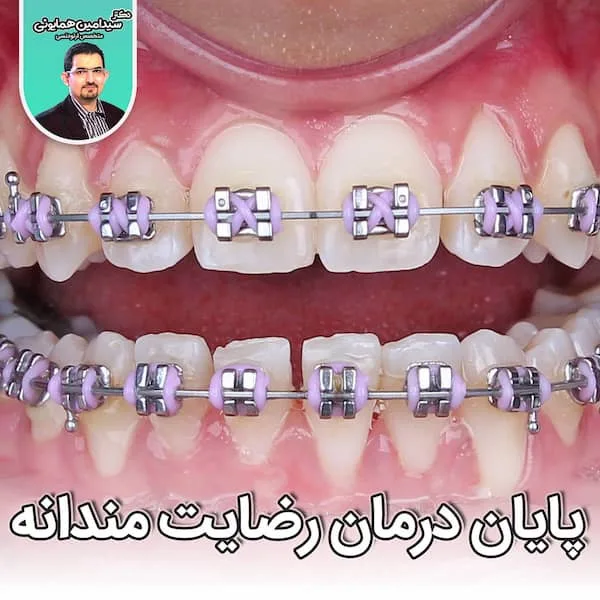 پایان درمان رضایت مندانه