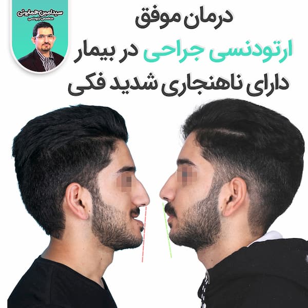 درمان موفق ارتودنسی جراحی در بیماردارای ناهنجاری شدید فکی