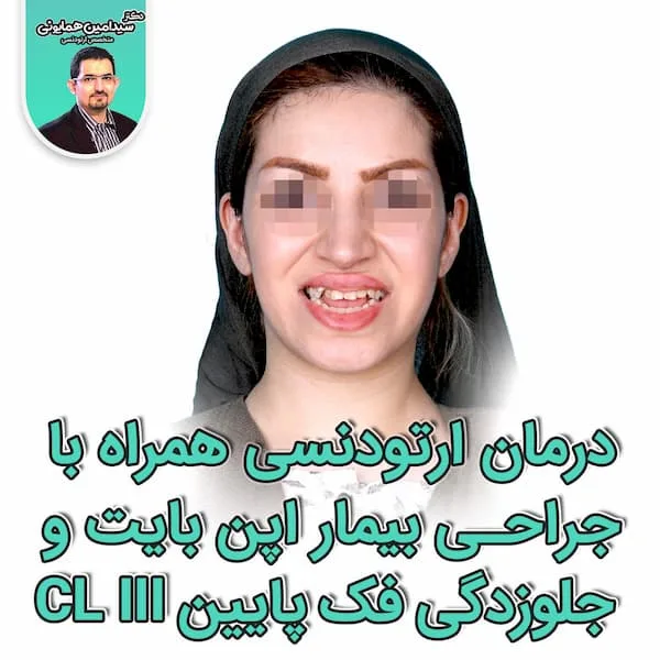 اپن بایت