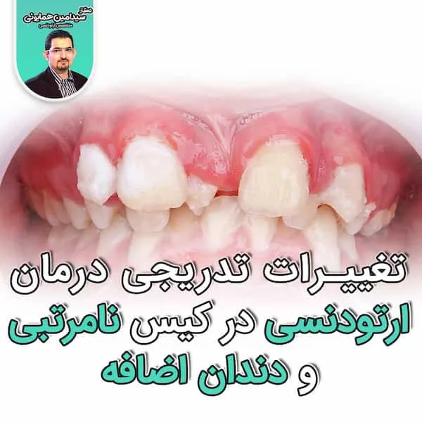 تغییرات تدریجی کشیدن دندان