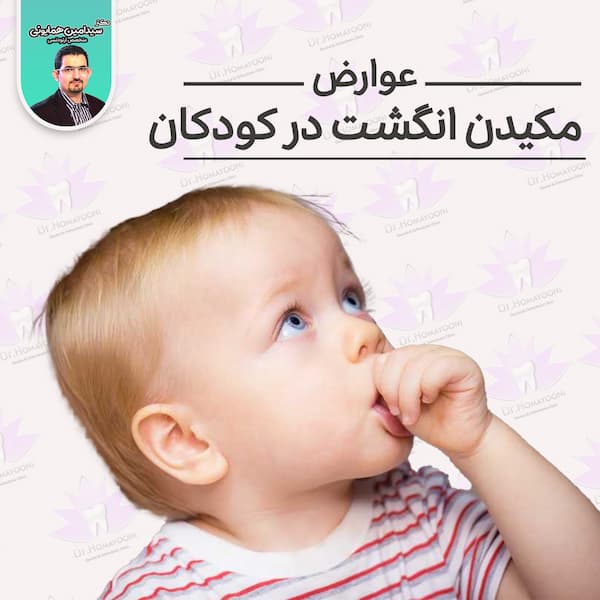 عوارض مکیدن انگشت در کودکان