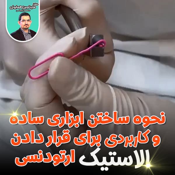 نحوه ساختن ابزاری ساده و کاربردی برای قرار دادن الاستیک ارتودنسی