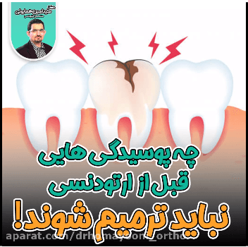 ترمیم دندان پوسیده
