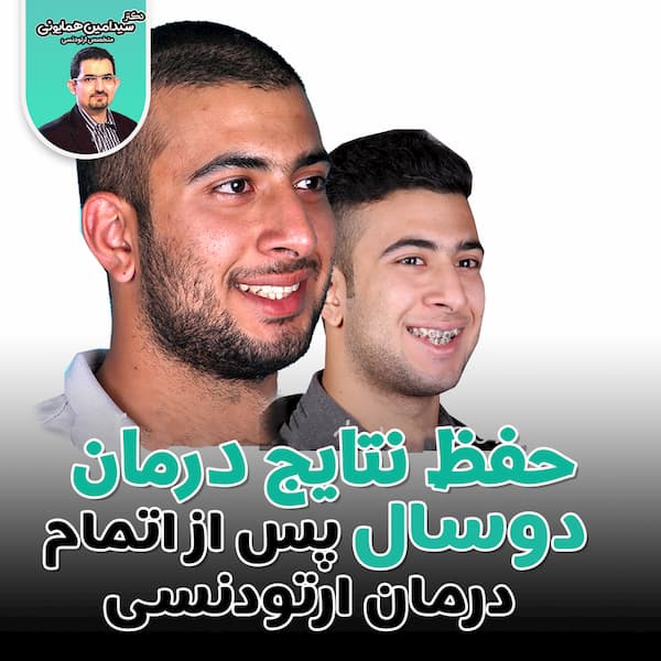 حفظ نتایج درمان 2 سال پس از اتمام ارتودنسی