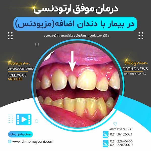 قالب ویدئو کاور