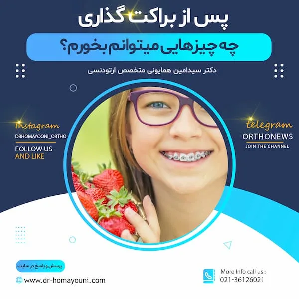 پس از براکت گذاری چه چیزهایی میتوانم بخورم؟ 1 چه چیزیهایی بخورم
