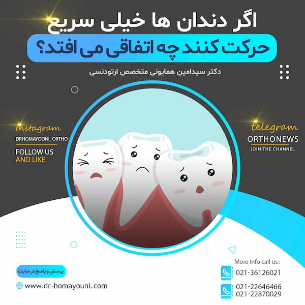 اگر دندان ها خیلی سریع حرکت کنند چه اتفاقی می افتد؟