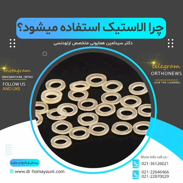 چرا الاستیک استفاده میشود؟ 1 چرا الاستیک استفاده میشود؟