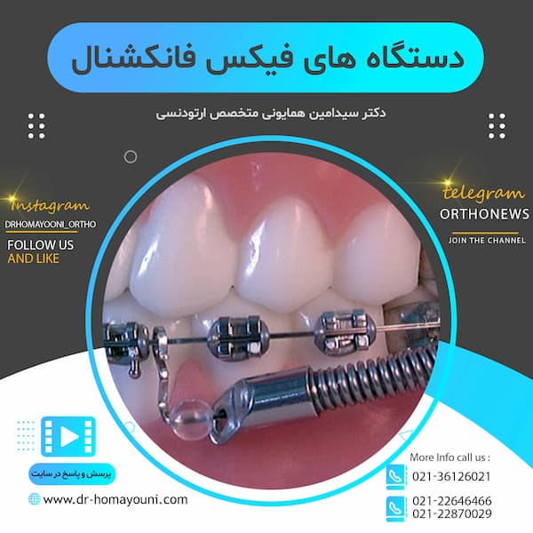 دستگاه های فیکس فانکشنال
