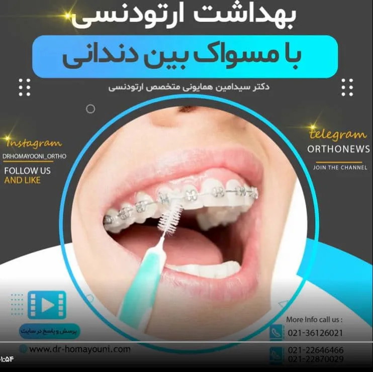 مسواک بین دهانی