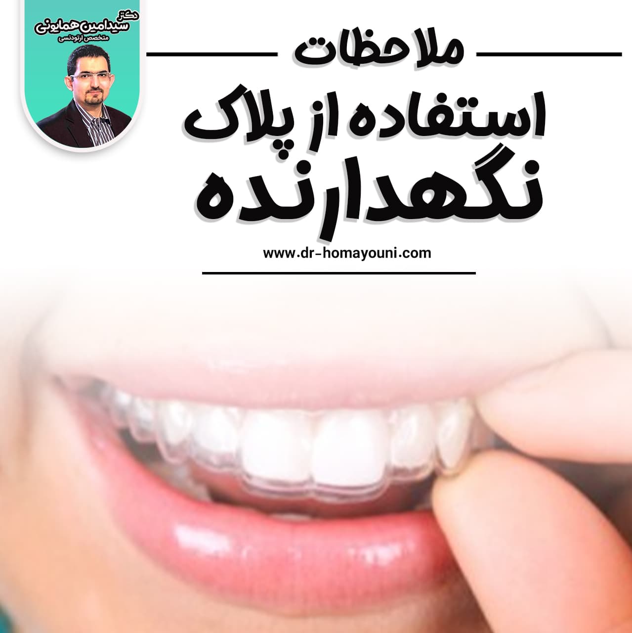 ملاحظات استفاده از پلاک نگهدارنده