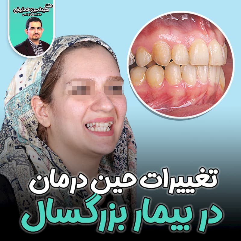 تغییرات حین درمان در بیمار بزرگسال