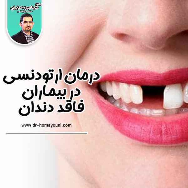 درمان ارتودنسی در بیماران فاقد دندان