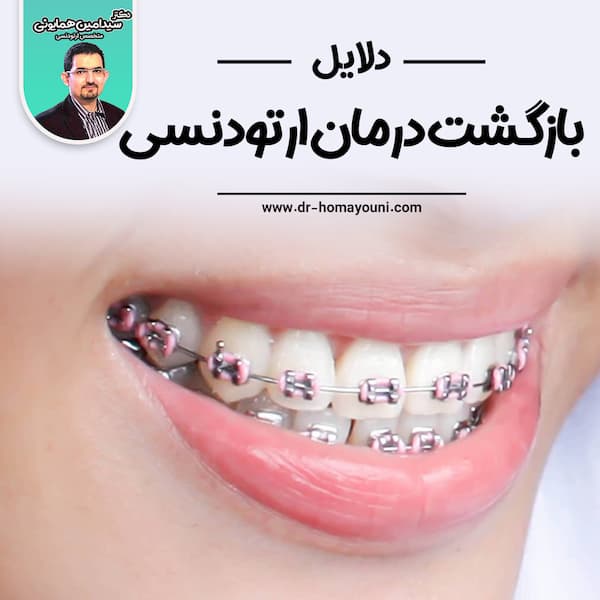 دلایل بازگشت درمان ارتودنسی