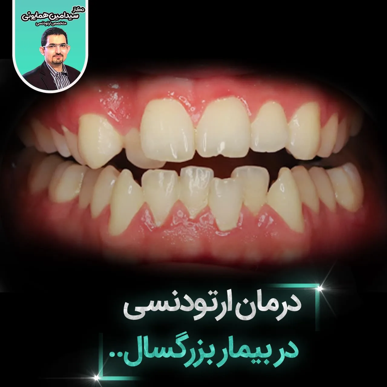 درمان ارتودنسی در بیمار بزرگسال..
