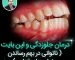 آیا می توان دستگاههای ارتودنسی به صورت موقت برداشت؟