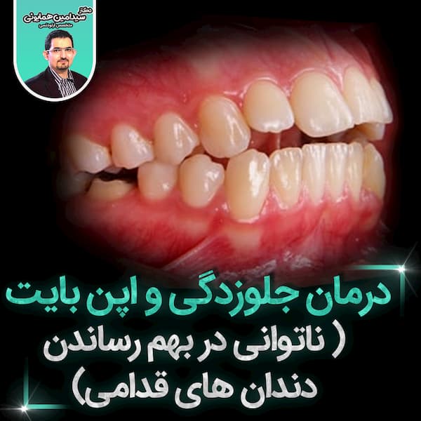 آیا می توان دستگاههای ارتودنسی به صورت موقت برداشت؟