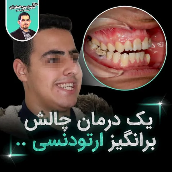یک درمان چالش برانگیز ارتودنسی ..