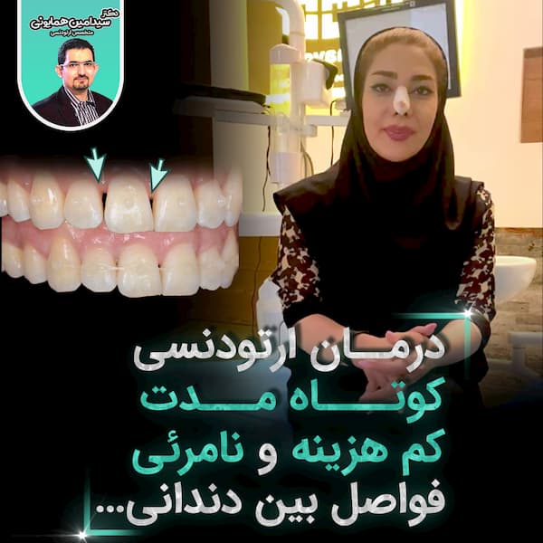 درمان ارتودنسی کوتاه مدت ، کم هزینه و نامرئی فواصل بین دندان