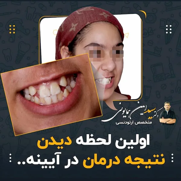 اولین لحظه دیدن نتیجه درمان در آیینه..