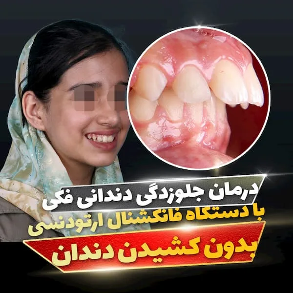 کاور (14)