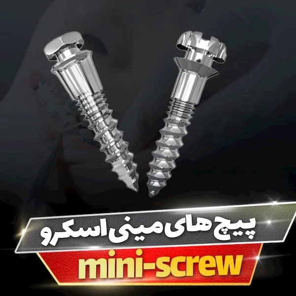 پیچ های mini-screw چیست؟ 1 پیچ های مینی اسکروو