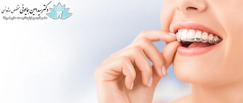 ارتودنسی متحرک بهتر است یا ثابت؟ 1 ارتودنسی متحرک بهتر است یا ثابت